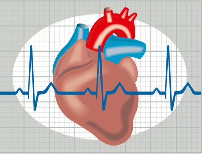 ecg1