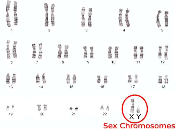 Cromossomos humanos