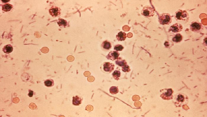 Imagen de la bacteria shigella
