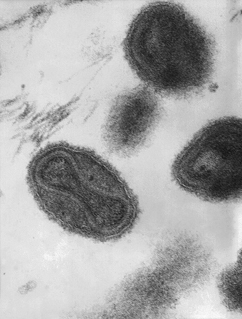virus variola