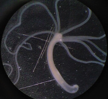 Imagen de hidra con cuerpo tubular y múltiples tentáculos.