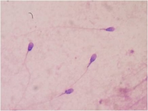 Células de esperma