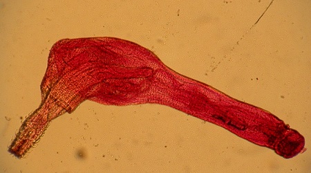 Una imagen a través de un microscopio de un gusano rojo de cabeza espinosa con pequeñas púas que cubren su cabeza.