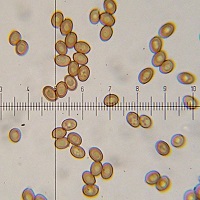 Esporas bajo microscopio