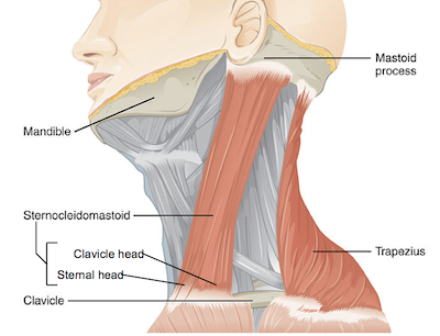 Esternocleidomastoideo