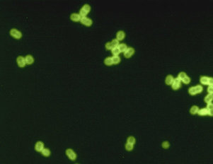 steotococos neumonia