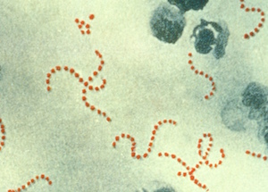Streptococcus pyrogenes