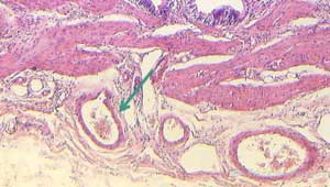 Arterias de muestra de tejido