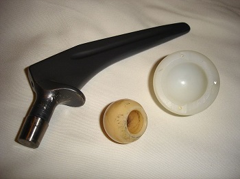Articulación de cadera