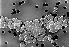Bacterias enterococos resistentes a la vancomicina