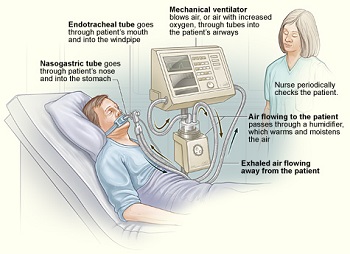 ventilador