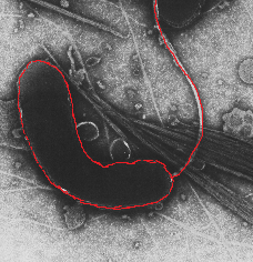 Vibrio cholerae tiene la forma de un perrito caliente doblado con cola