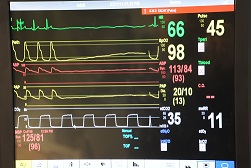 Monitorear los signos vitales