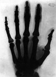 Mano Rayos X