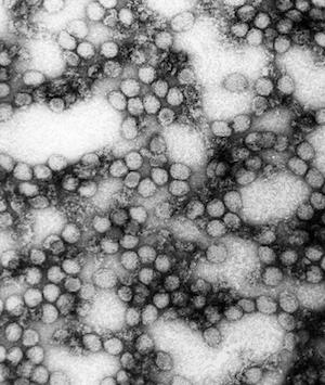 virus de la fiebre amarilla