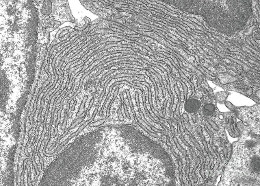 Figura 2: Micrografía electrónica de transmisión donde se aprecian las cisternas aplanadas del retículo endoplásmico rugoso y la alta densidad de ribosomas adheridos a sus membranas.