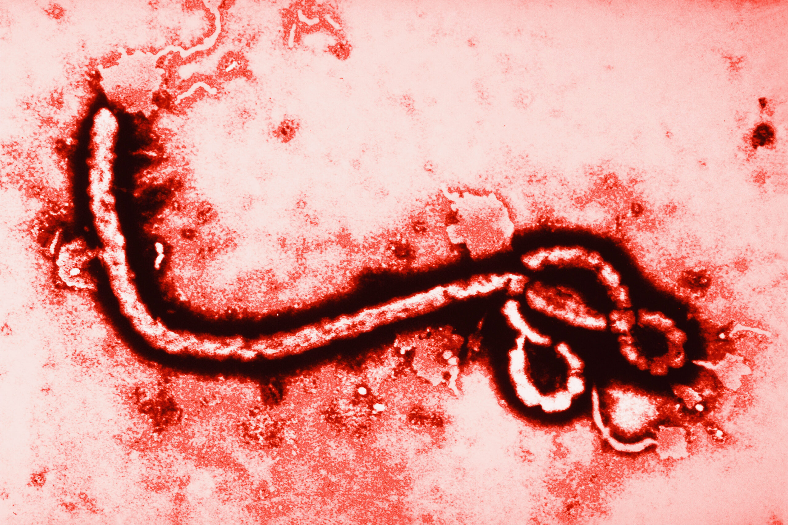 Virus del Ébola en un microscopio