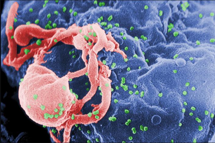 El VIH y el SIDA: Una Guía Integral de Comprensión y Prevención